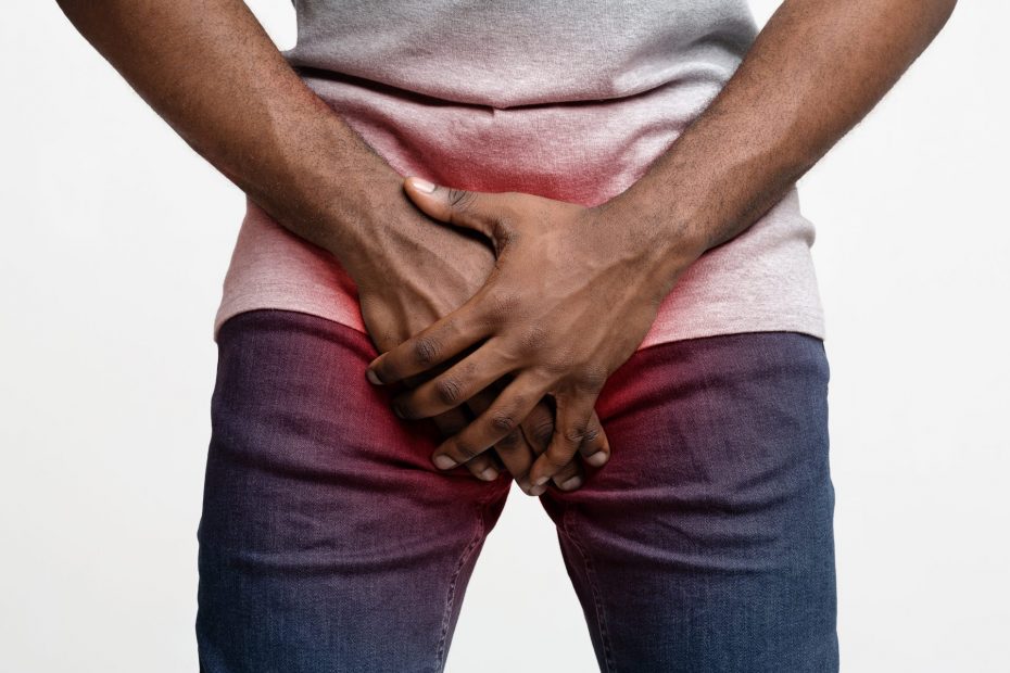 O homem afro cobrindo os seus genitais com ambas as mãos, com o conceito de doenças sexuais, colhidas